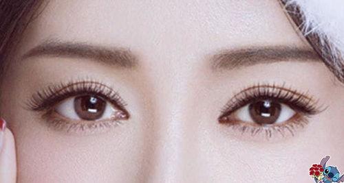 割双眼皮女明星,美丽蜕变背后的故事